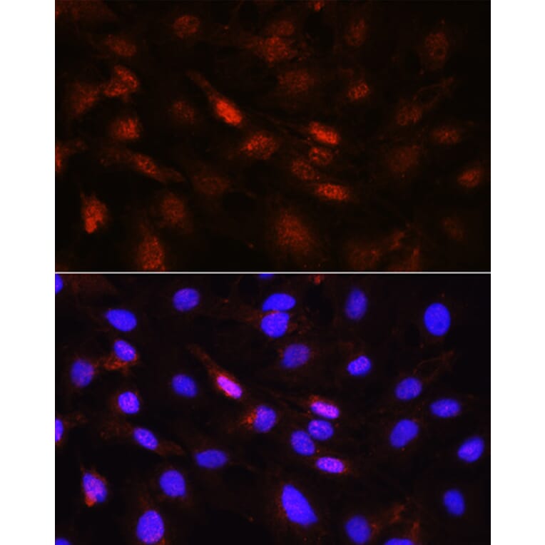 Immunofluorescence - Anti-PLK1 Antibody (A14053) - Antibodies.com