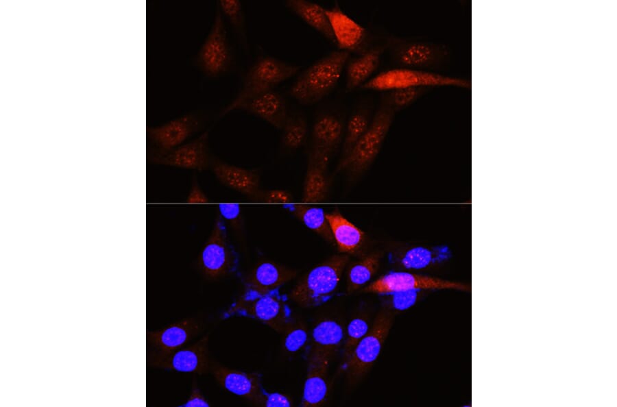 Immunofluorescence - Anti-PLK1 Antibody (A14053) - Antibodies.com