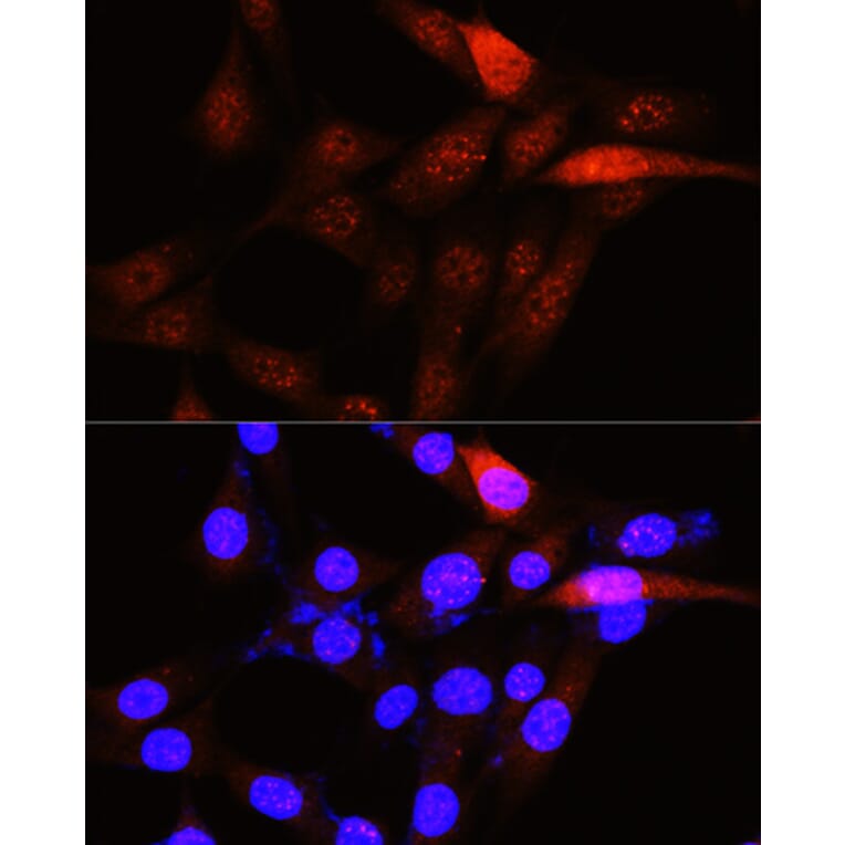Immunofluorescence - Anti-PLK1 Antibody (A14053) - Antibodies.com