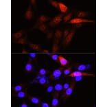 Immunofluorescence - Anti-PLK1 Antibody (A14053) - Antibodies.com