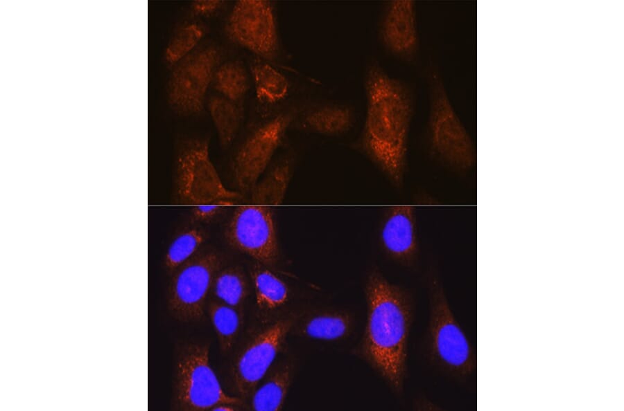 Immunofluorescence - Anti-PLK1 Antibody (A14053) - Antibodies.com