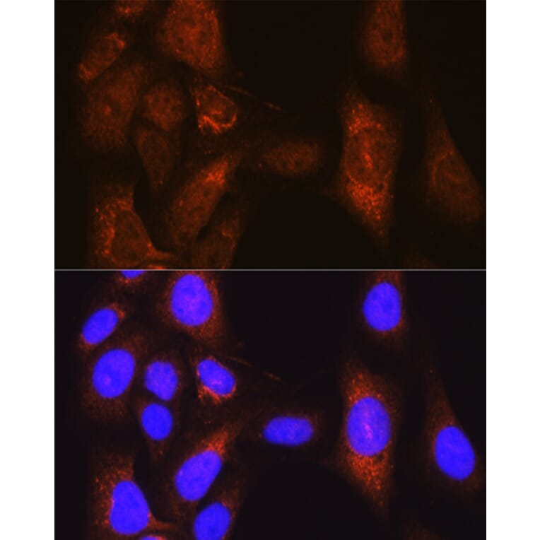 Immunofluorescence - Anti-PLK1 Antibody (A14053) - Antibodies.com