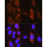 Immunofluorescence - Anti-PLK1 Antibody (A14053) - Antibodies.com