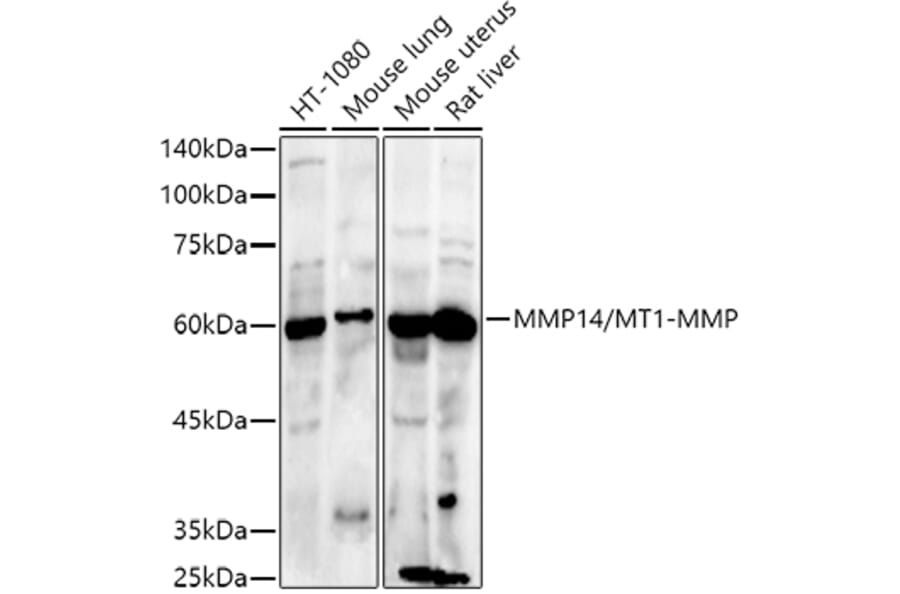 Western Blot - Anti-MMP14 Antibody (A14054) - Antibodies.com