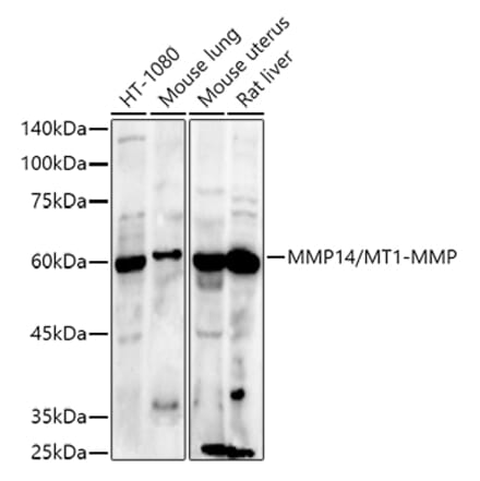 Western Blot - Anti-MMP14 Antibody (A14054) - Antibodies.com