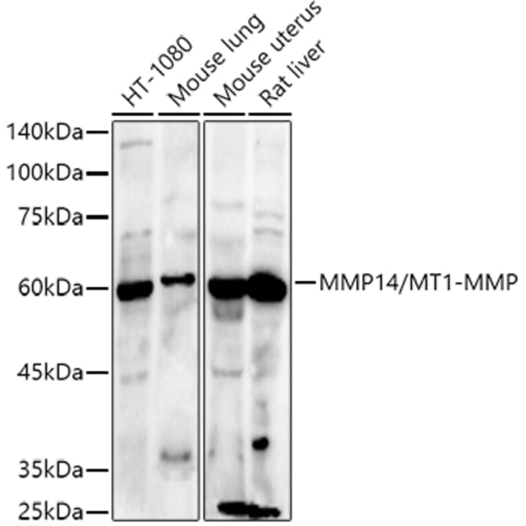 Western Blot - Anti-MMP14 Antibody (A14054) - Antibodies.com