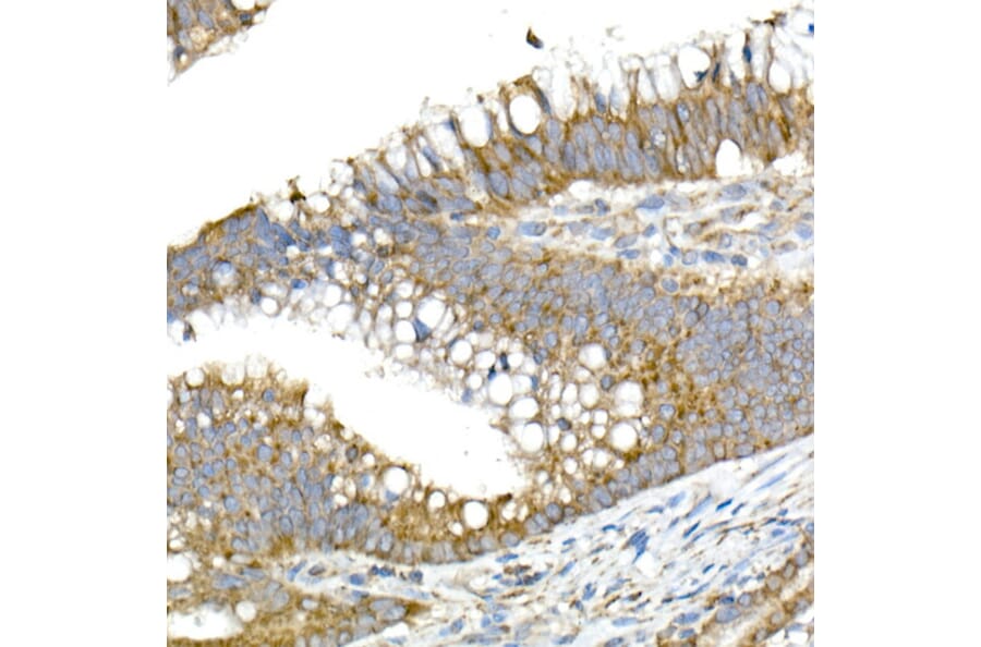 Immunohistochemistry - Anti-MMP14 Antibody (A14054) - Antibodies.com