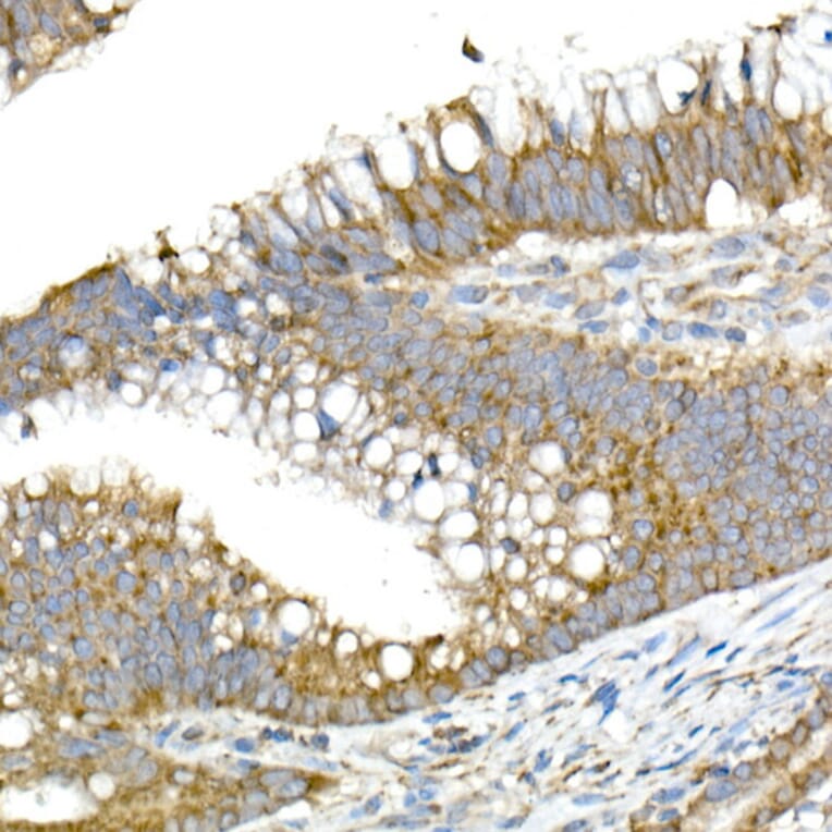 Immunohistochemistry - Anti-MMP14 Antibody (A14054) - Antibodies.com