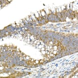 Immunohistochemistry - Anti-MMP14 Antibody (A14054) - Antibodies.com