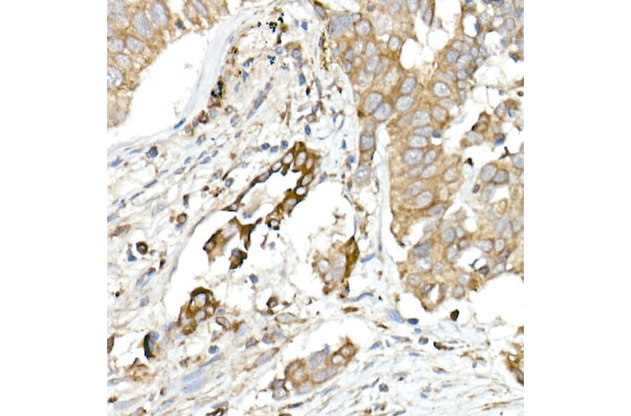 Immunohistochemistry - Anti-MMP14 Antibody (A14054) - Antibodies.com