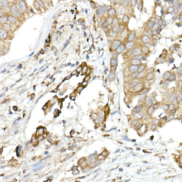 Immunohistochemistry - Anti-MMP14 Antibody (A14054) - Antibodies.com