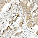 Immunohistochemistry - Anti-MMP14 Antibody (A14054) - Antibodies.com