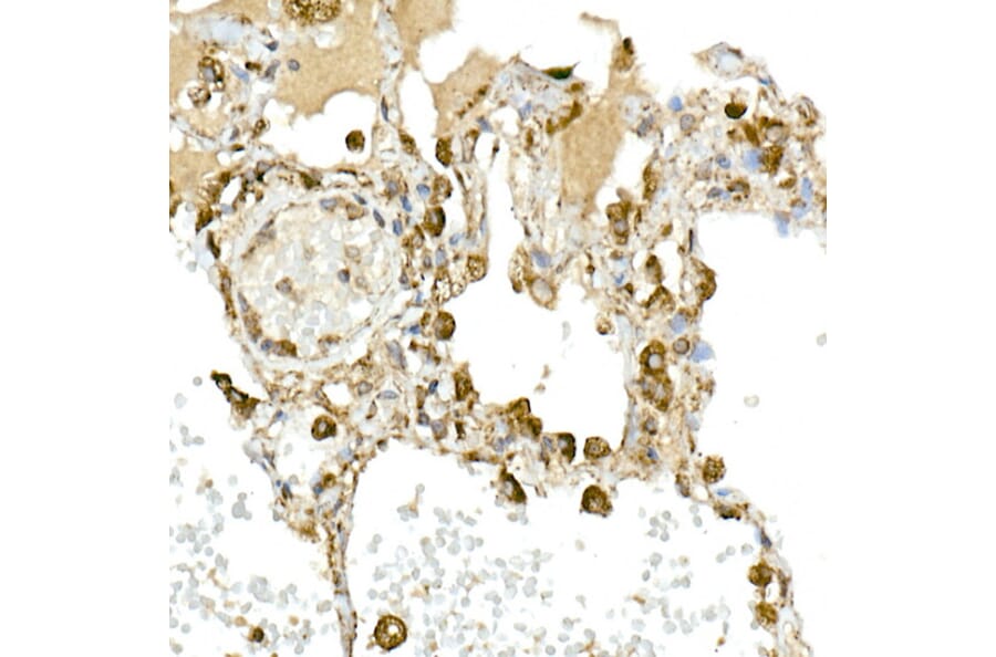 Immunohistochemistry - Anti-MMP14 Antibody (A14054) - Antibodies.com