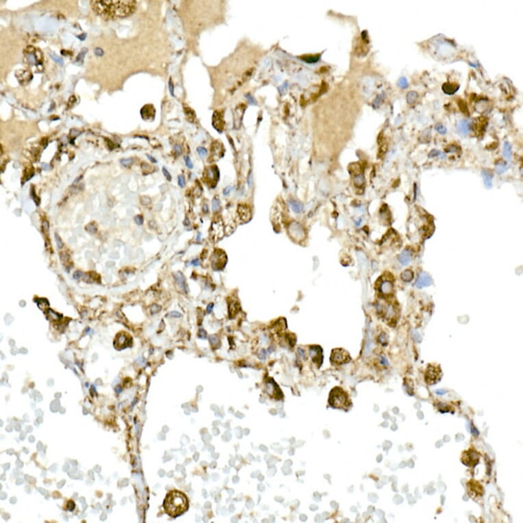 Immunohistochemistry - Anti-MMP14 Antibody (A14054) - Antibodies.com