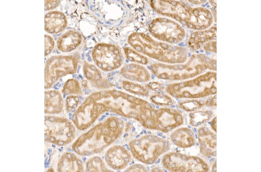 Immunohistochemistry - Anti-MMP14 Antibody (A14054) - Antibodies.com