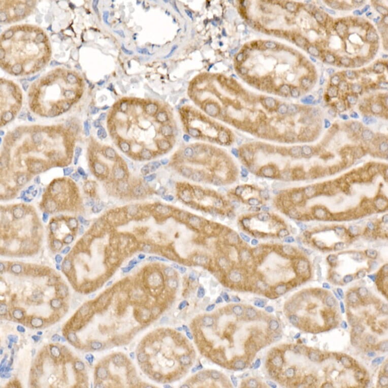 Immunohistochemistry - Anti-MMP14 Antibody (A14054) - Antibodies.com