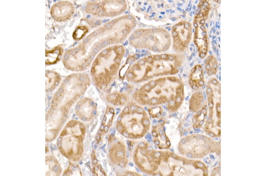 Immunohistochemistry - Anti-MMP14 Antibody (A14054) - Antibodies.com