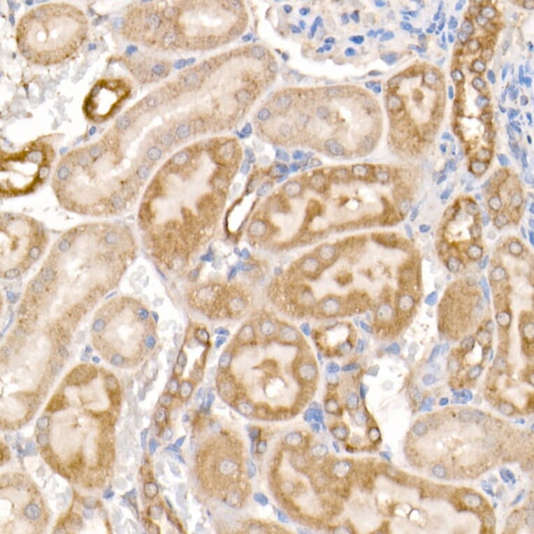 Immunohistochemistry - Anti-MMP14 Antibody (A14054) - Antibodies.com