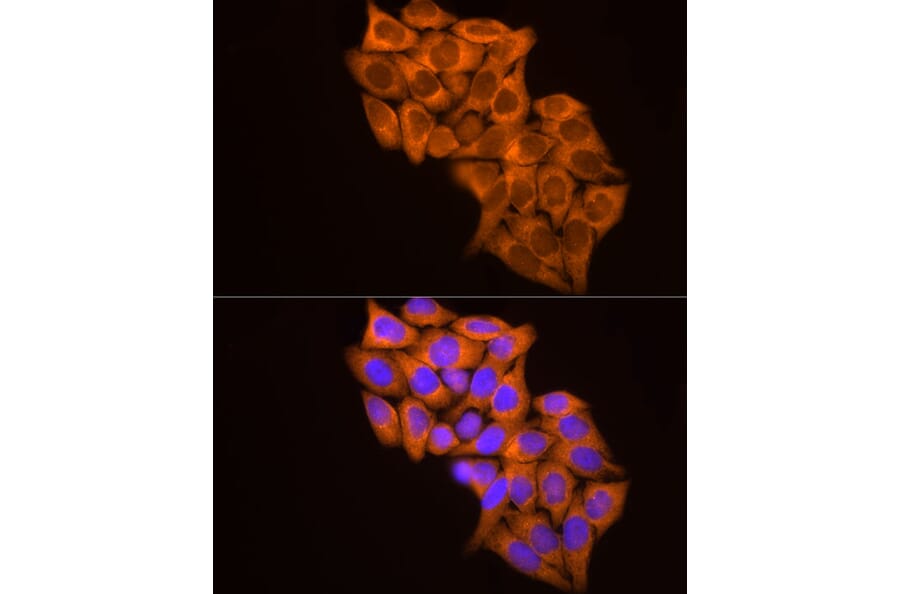 Immunofluorescence - Anti-MMP14 Antibody (A14054) - Antibodies.com