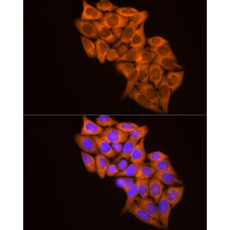 Immunofluorescence - Anti-MMP14 Antibody (A14054) - Antibodies.com