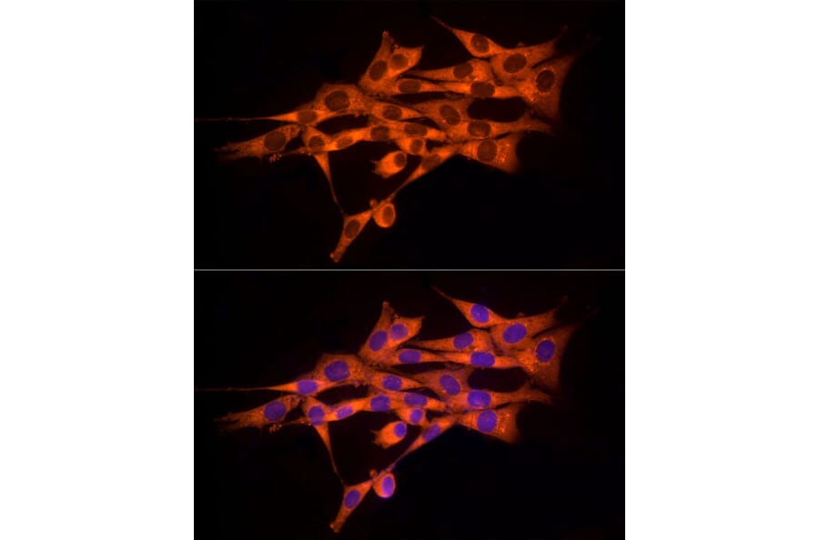 Immunofluorescence - Anti-MMP14 Antibody (A14054) - Antibodies.com