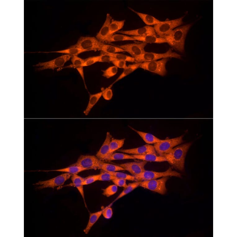 Immunofluorescence - Anti-MMP14 Antibody (A14054) - Antibodies.com