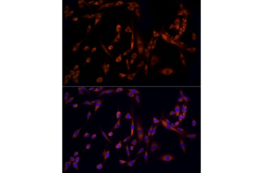 Immunofluorescence - Anti-MMP14 Antibody (A14054) - Antibodies.com