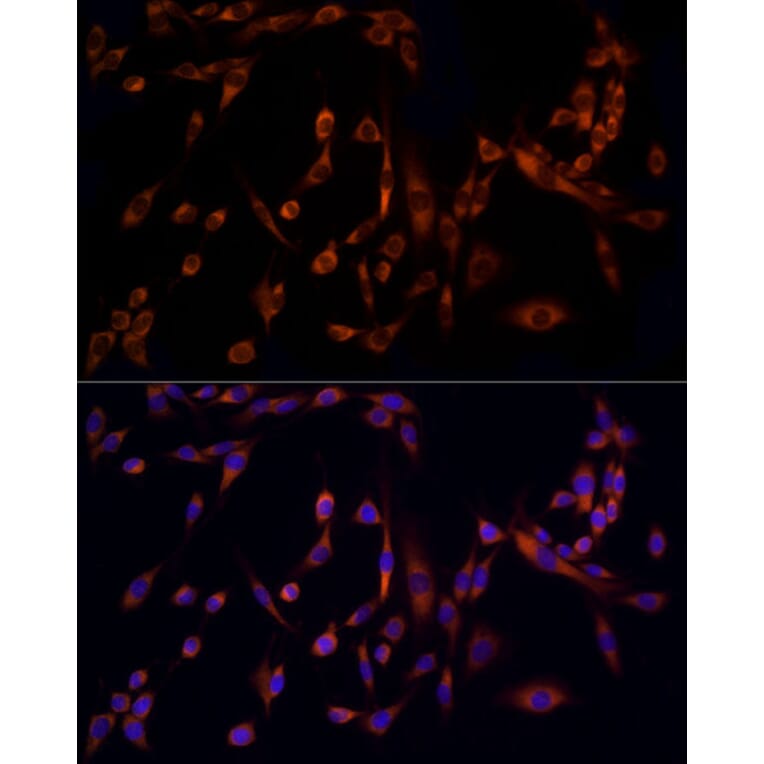 Immunofluorescence - Anti-MMP14 Antibody (A14054) - Antibodies.com