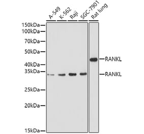 Western Blot - Anti-RANKL Antibody (A14055) - Antibodies.com