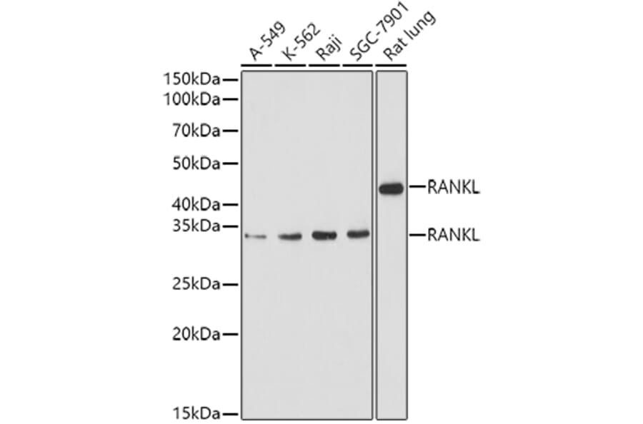 Western Blot - Anti-RANKL Antibody (A14055) - Antibodies.com
