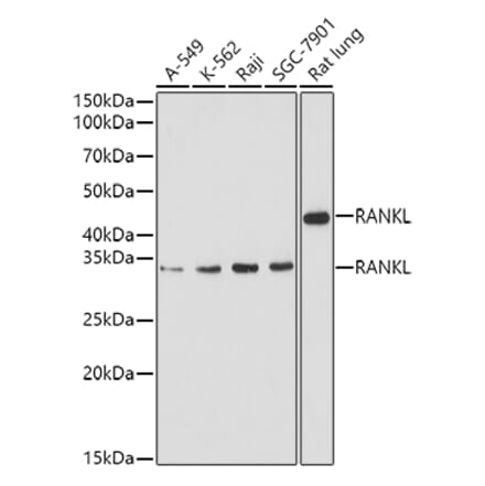 Western Blot - Anti-RANKL Antibody (A14055) - Antibodies.com