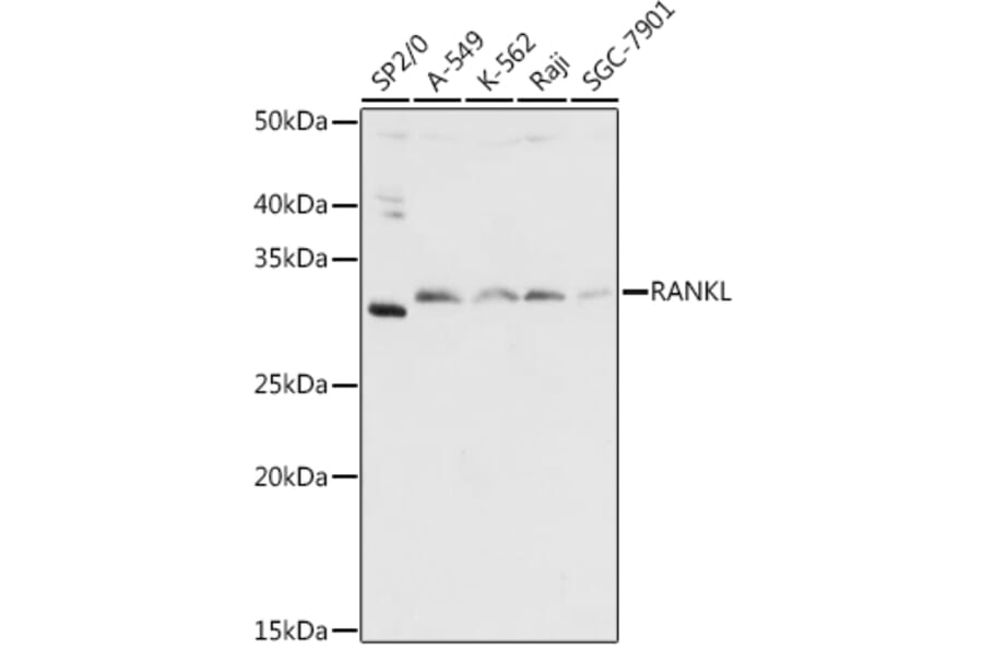 Western Blot - Anti-RANKL Antibody (A14055) - Antibodies.com