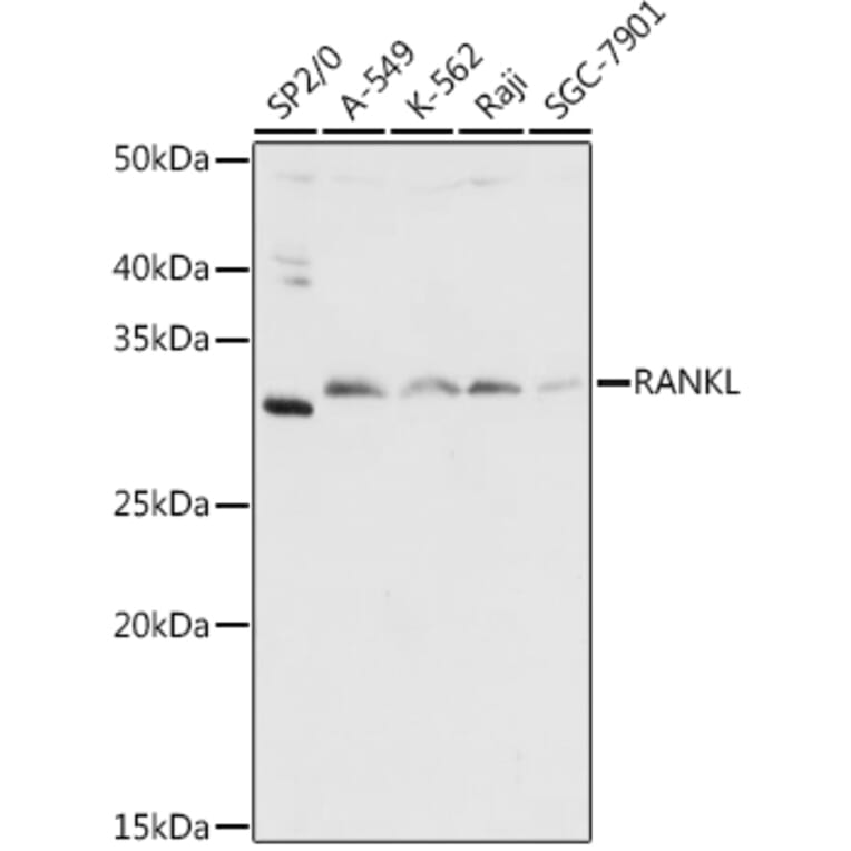 Western Blot - Anti-RANKL Antibody (A14055) - Antibodies.com