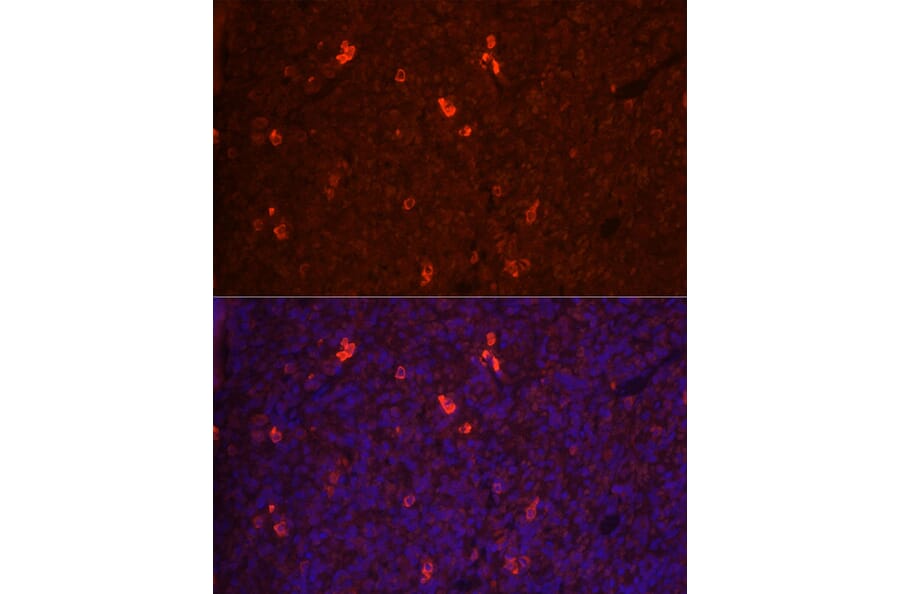 Immunofluorescence - Anti-RANKL Antibody (A14055) - Antibodies.com