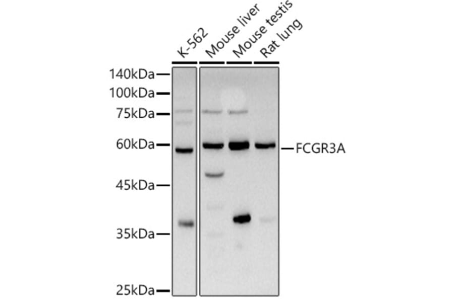 Western Blot - Anti-CD16 Antibody (A14056) - Antibodies.com