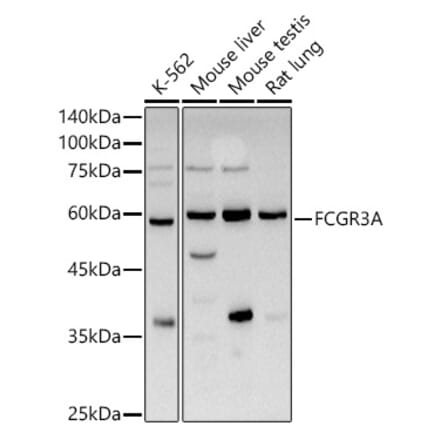 Western Blot - Anti-CD16 Antibody (A14056) - Antibodies.com