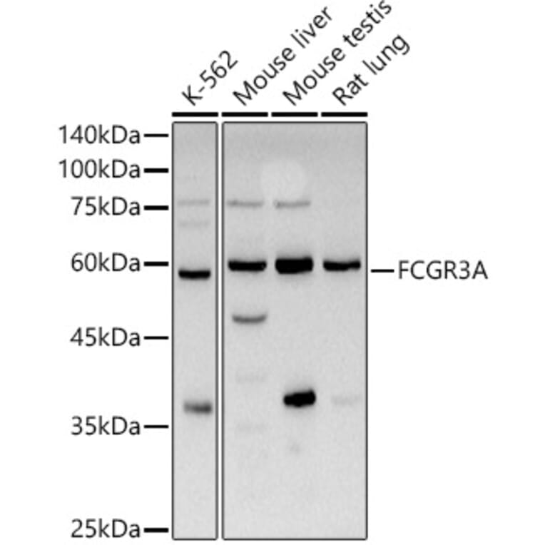Western Blot - Anti-CD16 Antibody (A14056) - Antibodies.com