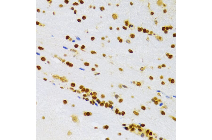 Immunohistochemistry - Anti-HMGB1 Antibody (A14057) - Antibodies.com