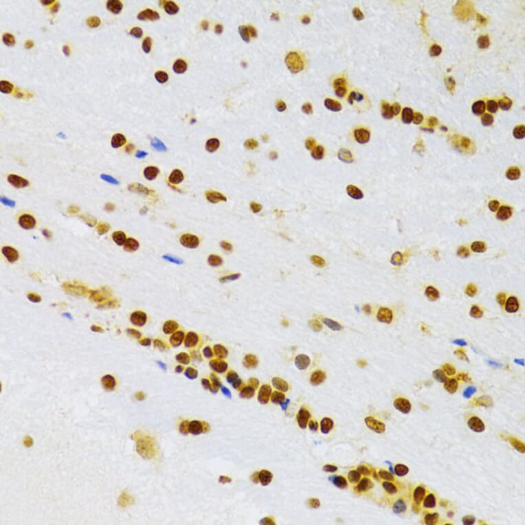 Immunohistochemistry - Anti-HMGB1 Antibody (A14057) - Antibodies.com