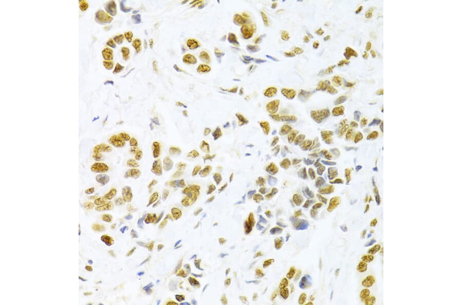 Immunohistochemistry - Anti-HMGB1 Antibody (A14057) - Antibodies.com