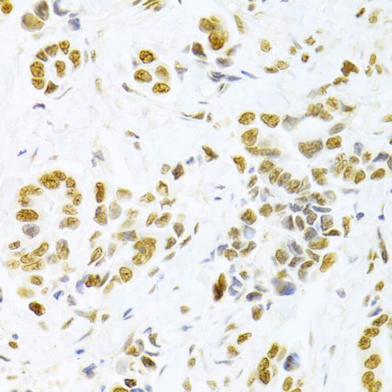 Immunohistochemistry - Anti-HMGB1 Antibody (A14057) - Antibodies.com