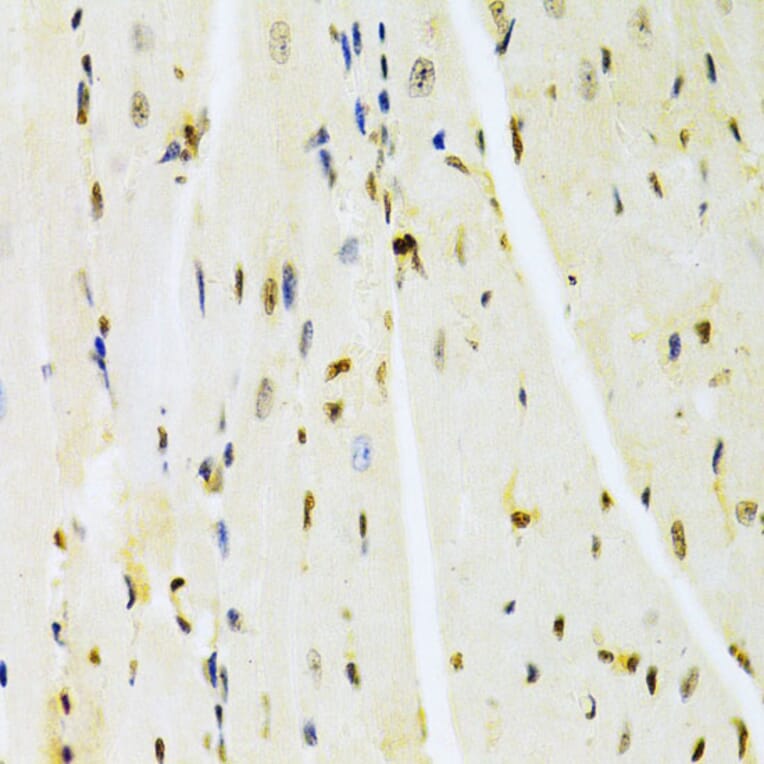 Immunohistochemistry - Anti-HMGB1 Antibody (A14057) - Antibodies.com