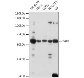 Western Blot - Anti-PAK1 Antibody (A14058) - Antibodies.com