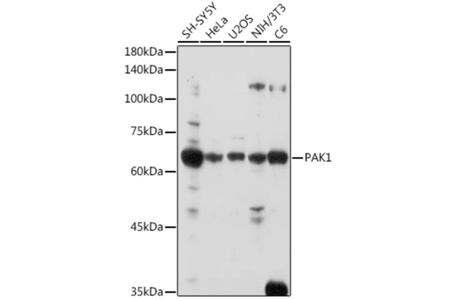 Western Blot - Anti-PAK1 Antibody (A14058) - Antibodies.com