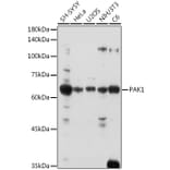 Western Blot - Anti-PAK1 Antibody (A14058) - Antibodies.com