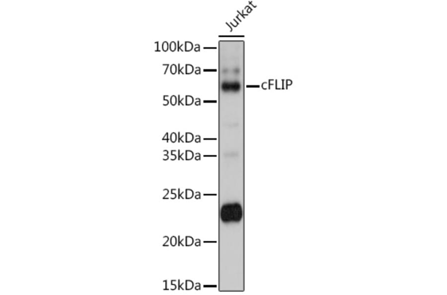 Western Blot - Anti-FLIP Antibody (A14059) - Antibodies.com