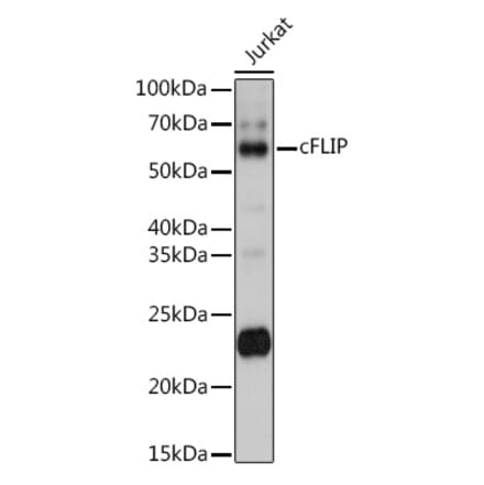 Western Blot - Anti-FLIP Antibody (A14059) - Antibodies.com