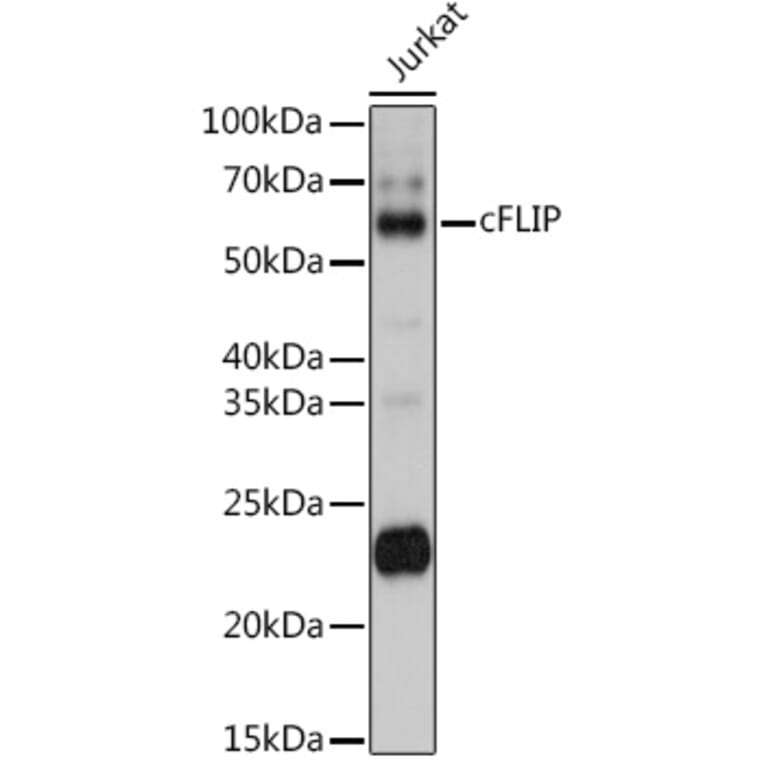 Western Blot - Anti-FLIP Antibody (A14059) - Antibodies.com