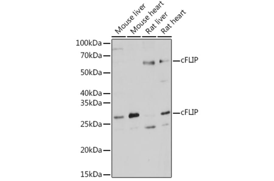 Western Blot - Anti-FLIP Antibody (A14059) - Antibodies.com