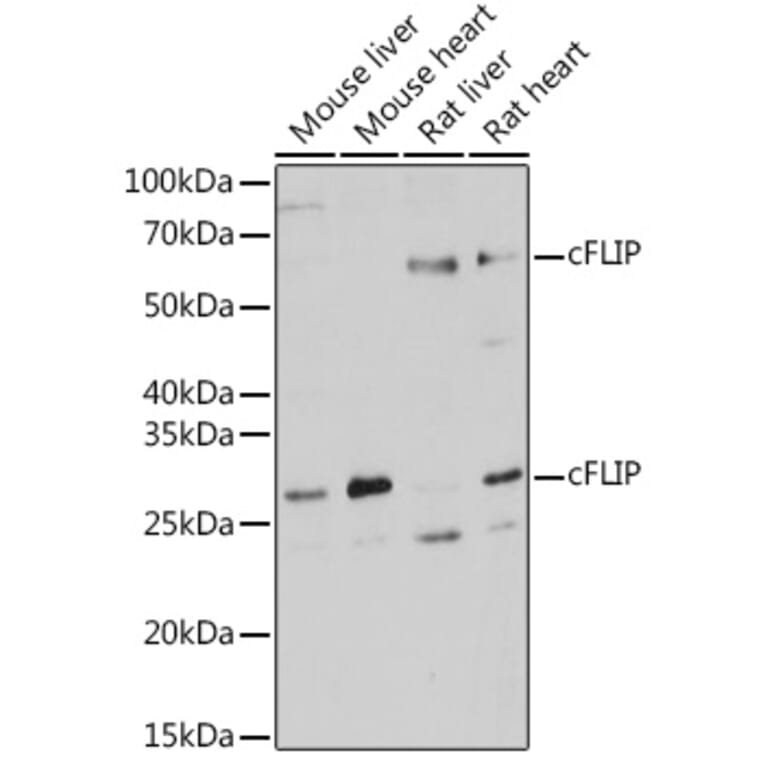 Western Blot - Anti-FLIP Antibody (A14059) - Antibodies.com